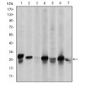 anti-HYAL1 antibody (Hyaluronidase-1) (N-Term)