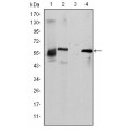 anti-HYAL1 antibody (Hyaluronidase-1) (N-Term)
