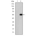 anti-HYAL1 antibody (Hyaluronidase-1) (N-Term)