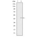 anti-HYAL1 antibody (Hyaluronidase-1) (N-Term)