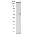 anti-HYAL1 antibody (Hyaluronidase-1) (N-Term)