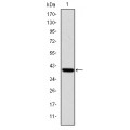 anti-HYAL1 antibody (Hyaluronidase-1) (N-Term)