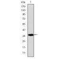 anti-HYAL1 antibody (Hyaluronidase-1) (N-Term)