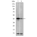 anti-HYAL1 antibody (Hyaluronidase-1) (N-Term)