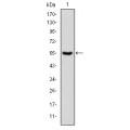 anti-HYAL1 antibody (Hyaluronidase-1) (N-Term)