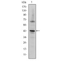 anti-HYAL1 antibody (Hyaluronidase-1) (N-Term)