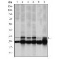 anti-HYAL1 antibody (Hyaluronidase-1) (N-Term)
