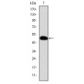 anti-HYAL1 antibody (Hyaluronidase-1) (N-Term)