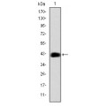 anti-HYAL1 antibody (Hyaluronidase-1) (N-Term)