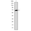 anti-HYAL1 antibody (Hyaluronidase-1) (N-Term)