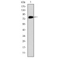 anti-HYAL1 antibody (Hyaluronidase-1) (N-Term)