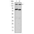 anti-HYAL1 antibody (Hyaluronidase-1) (N-Term)