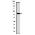anti-HYAL1 antibody (Hyaluronidase-1) (N-Term)