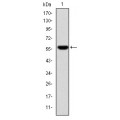 anti-HYAL1 antibody (Hyaluronidase-1) (N-Term)
