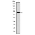 anti-HYAL1 antibody (Hyaluronidase-1) (N-Term)