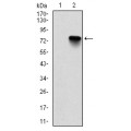 anti-HYAL1 antibody (Hyaluronidase-1) (N-Term)