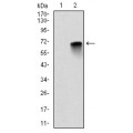 anti-HYAL1 antibody (Hyaluronidase-1) (N-Term)