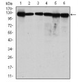 anti-HYAL1 antibody (Hyaluronidase-1) (N-Term)