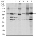 anti-HYAL1 antibody (Hyaluronidase-1) (N-Term)