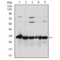 anti-HYAL1 antibody (Hyaluronidase-1) (N-Term)