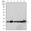 anti-HYAL1 antibody (Hyaluronidase-1) (N-Term)
