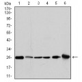 anti-HYAL1 antibody (Hyaluronidase-1) (N-Term)