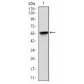 anti-HYAL1 antibody (Hyaluronidase-1) (N-Term)