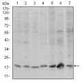 anti-HYAL1 antibody (Hyaluronidase-1) (N-Term)