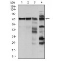anti-HYAL1 antibody (Hyaluronidase-1) (N-Term)