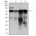 anti-HYAL1 antibody (Hyaluronidase-1) (N-Term)