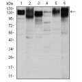 anti-HYAL1 antibody (Hyaluronidase-1) (N-Term)