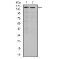 anti-HYAL1 antibody (Hyaluronidase-1) (N-Term)