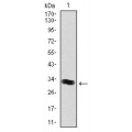 anti-HYAL1 antibody (Hyaluronidase-1) (N-Term)