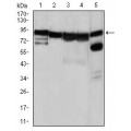 anti-HYAL1 antibody (Hyaluronidase-1) (N-Term)