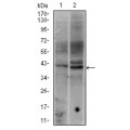 anti-HYAL1 antibody (Hyaluronidase-1) (N-Term)