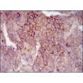 anti-HYAL1 antibody (Hyaluronidase-1) (N-Term)
