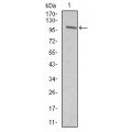 anti-HYAL1 antibody (Hyaluronidase-1) (N-Term)