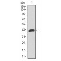 anti-HYAL1 antibody (Hyaluronidase-1) (N-Term)