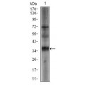 anti-HYAL1 antibody (Hyaluronidase-1) (N-Term)