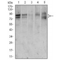anti-HYAL1 antibody (Hyaluronidase-1) (N-Term)