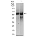 anti-HYAL1 antibody (Hyaluronidase-1) (N-Term)