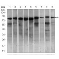 anti-HYAL1 antibody (Hyaluronidase-1) (N-Term)
