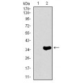 anti-HYAL1 antibody (Hyaluronidase-1) (N-Term)