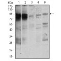 anti-HYAL1 antibody (Hyaluronidase-1) (N-Term)