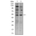 anti-HYAL1 antibody (Hyaluronidase-1) (N-Term)