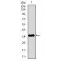 anti-HYAL1 antibody (Hyaluronidase-1) (N-Term)