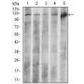 anti-HYAL1 antibody (Hyaluronidase-1) (N-Term)