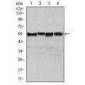 anti-HYAL1 antibody (Hyaluronidase-1) (N-Term)