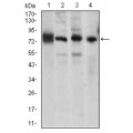 anti-HYAL1 antibody (Hyaluronidase-1) (N-Term)