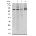 anti-HYAL1 antibody (Hyaluronidase-1) (N-Term)